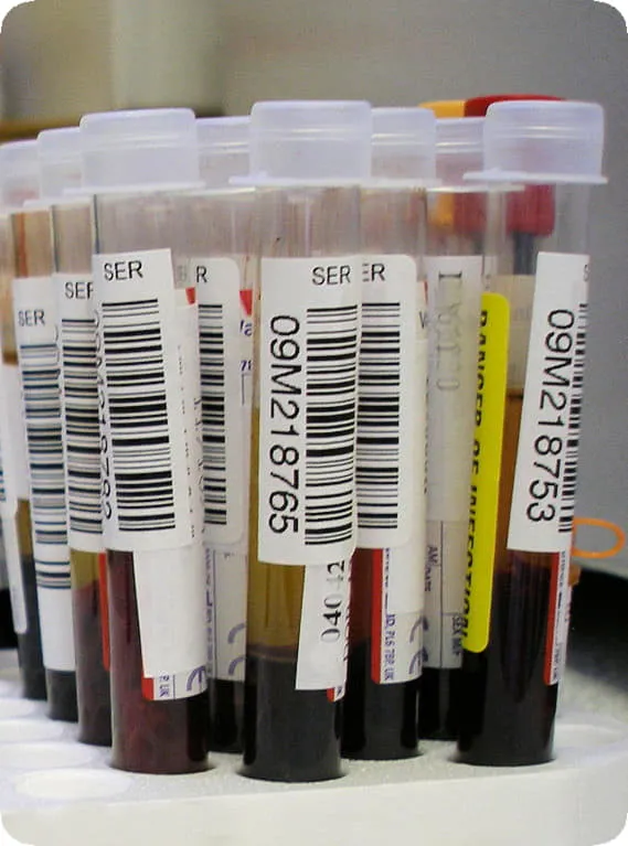 Blood Samples Stored at Labitus Blood Samples Stored at Labitus